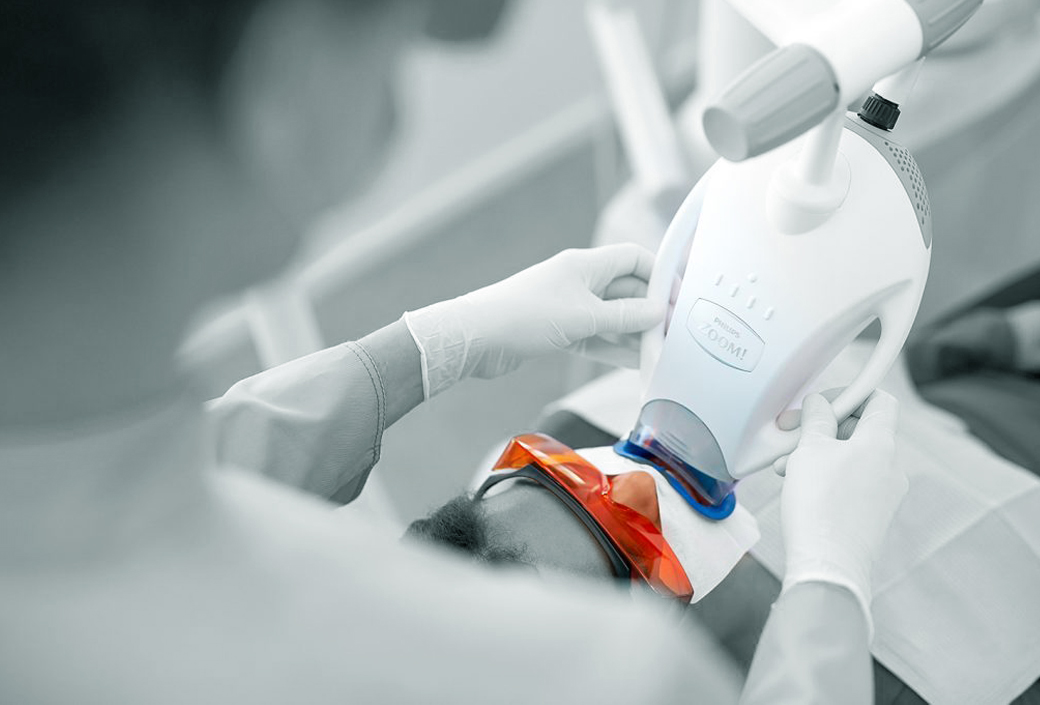 Zoom 4: плюсы и минусы отбеливания зубов по современной технологии