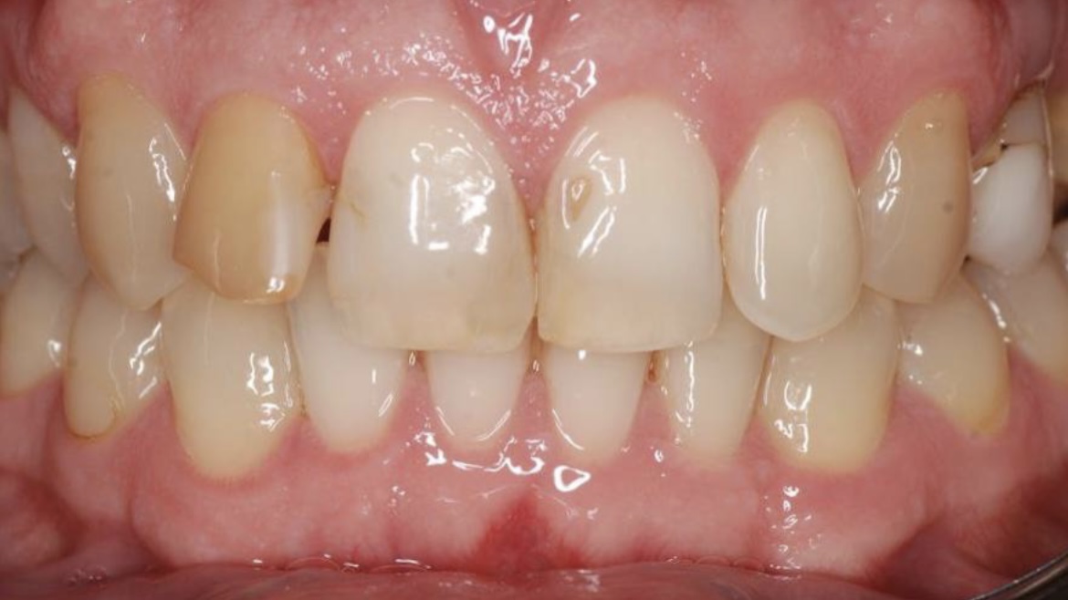 Air Flow до чистки