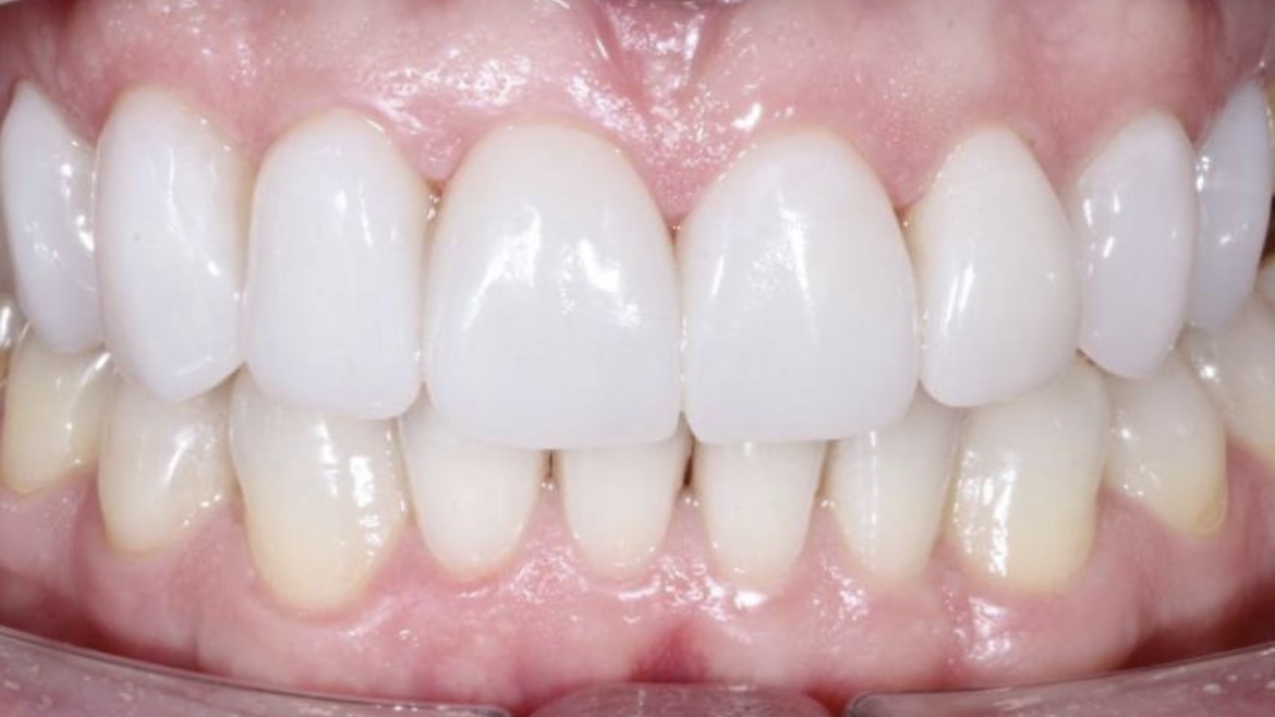 Air Flow после чистки