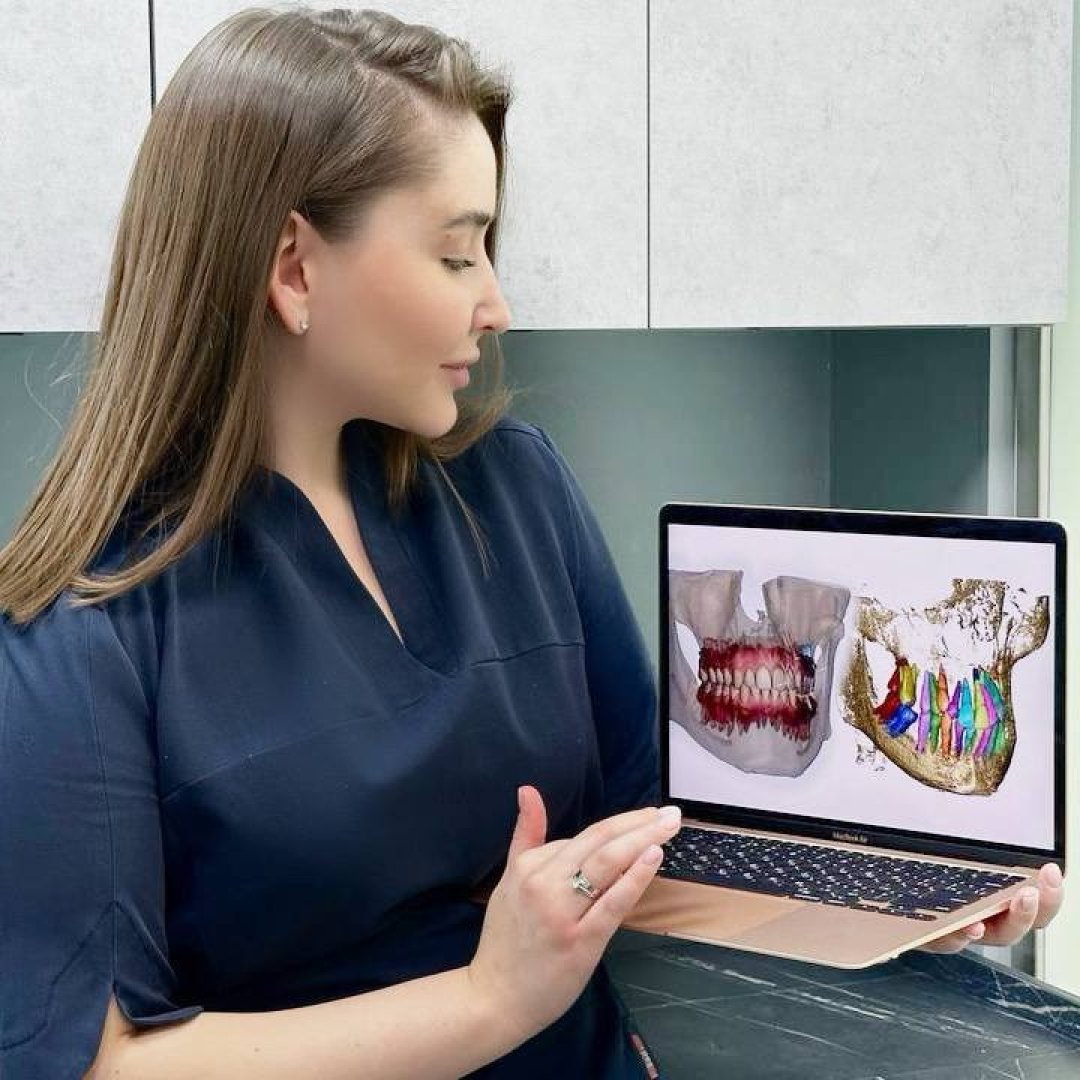 Элайнеры с памятью формы: Путь к идеальной улыбке — изображение 6