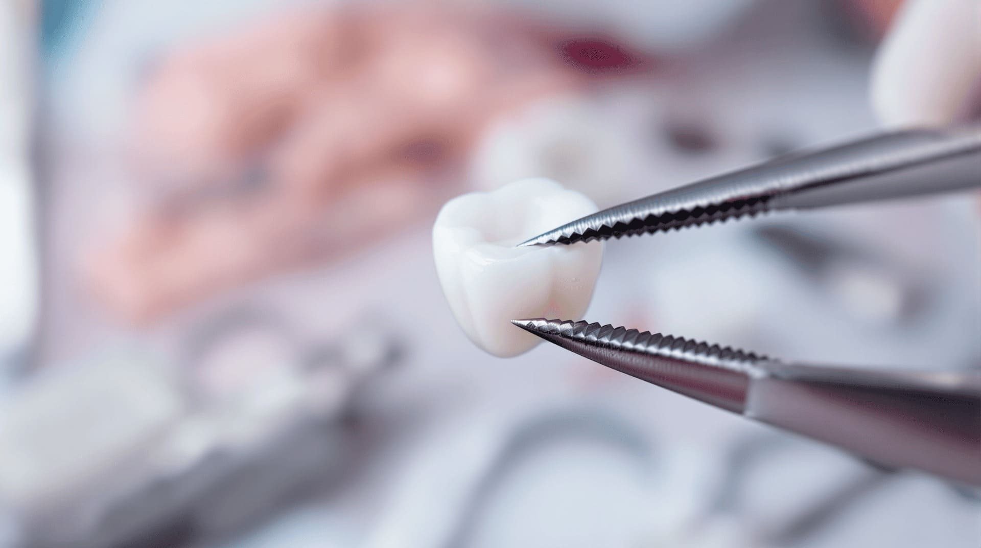 Циркониевые коронки конструкция