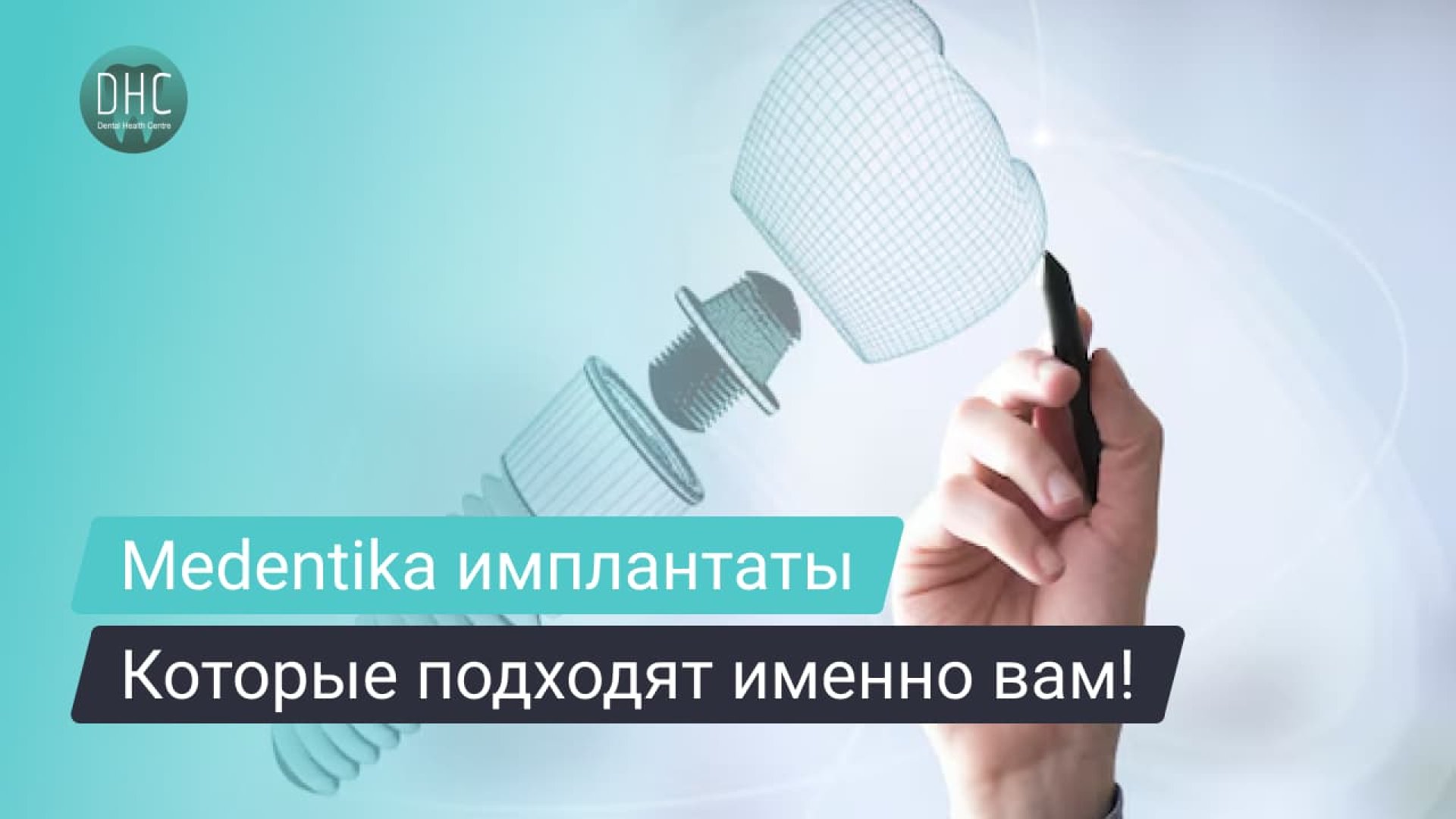 Как выбрать подходящую систему имплантатов: обзор Medentika hero