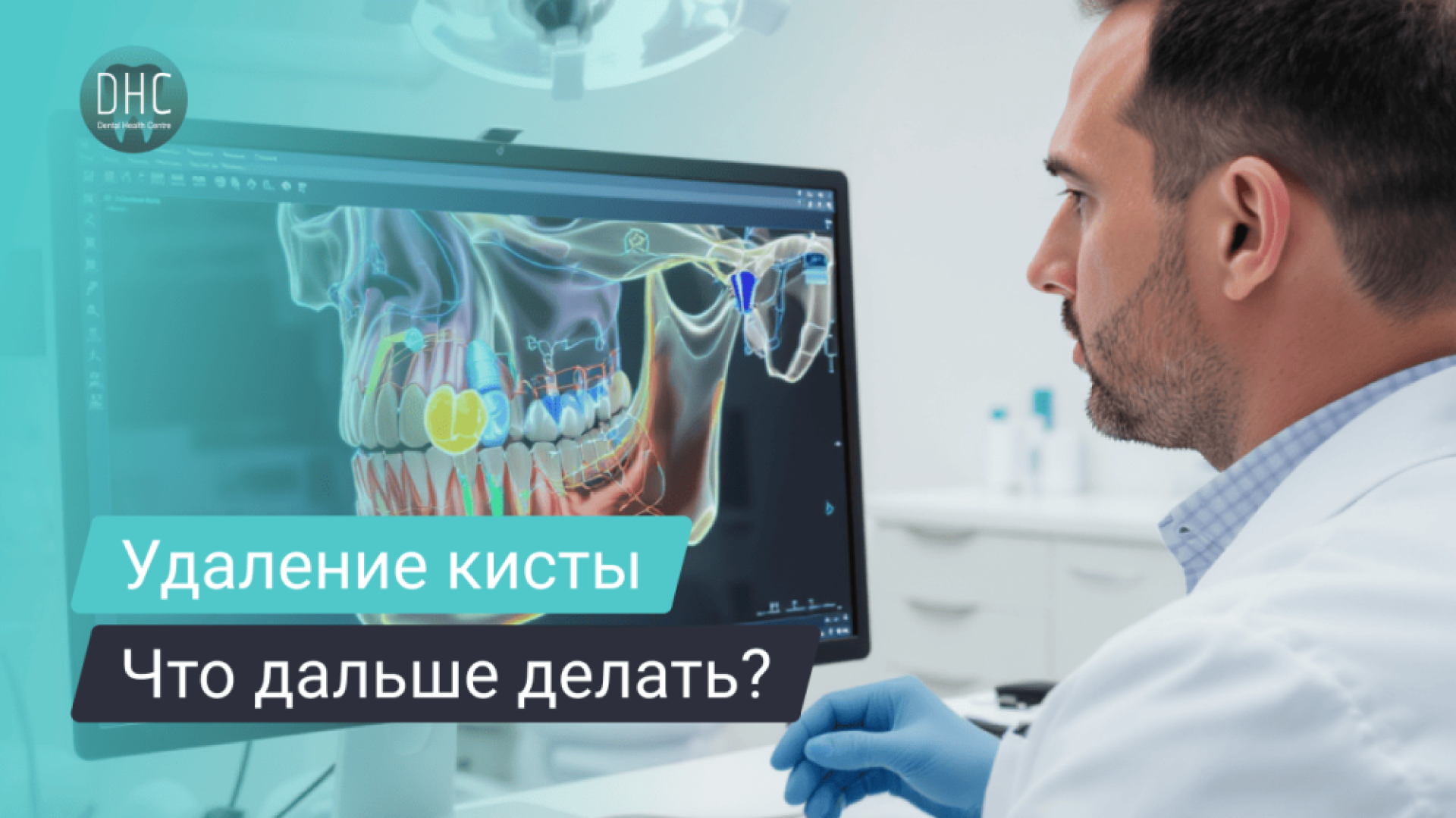 Имплантация после удаления кисты: сроки, риски и варианты лечения