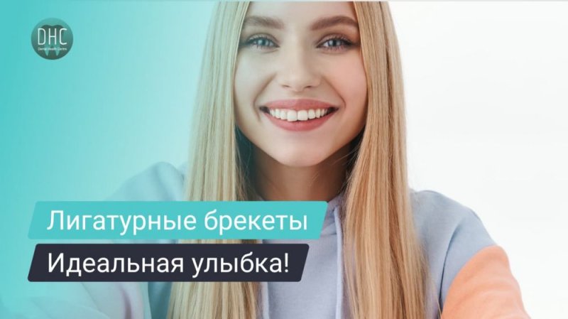 Лигатурные брекеты: что это и как выбрать?