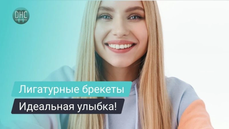 Лигатурные брекеты: что это и как выбрать?