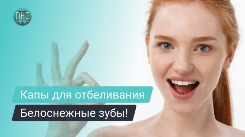 Капы для отбеливания зубов: что это такое и как отбеливают зубы