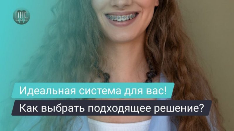 Брекеты: как выбрать подходящую систему для вашего случая.