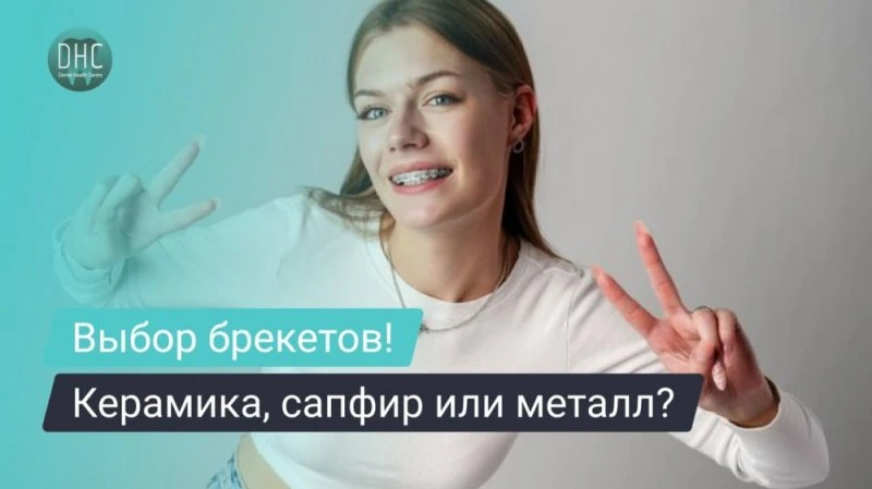 Керамические, сапфировые и металлические брекеты: что выбрать?