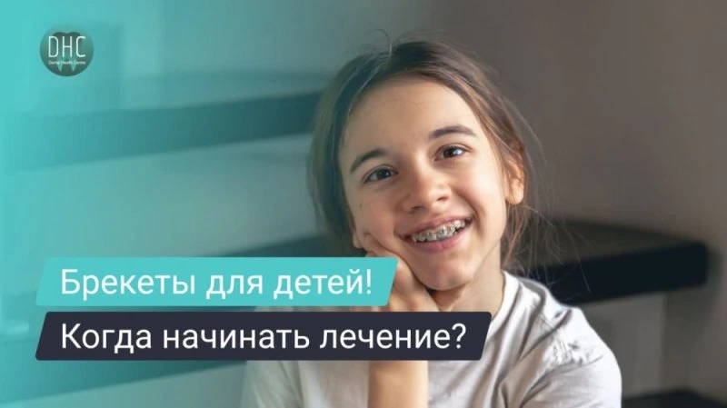 Брекеты для детей и подростков: когда лучше начинать лечение?