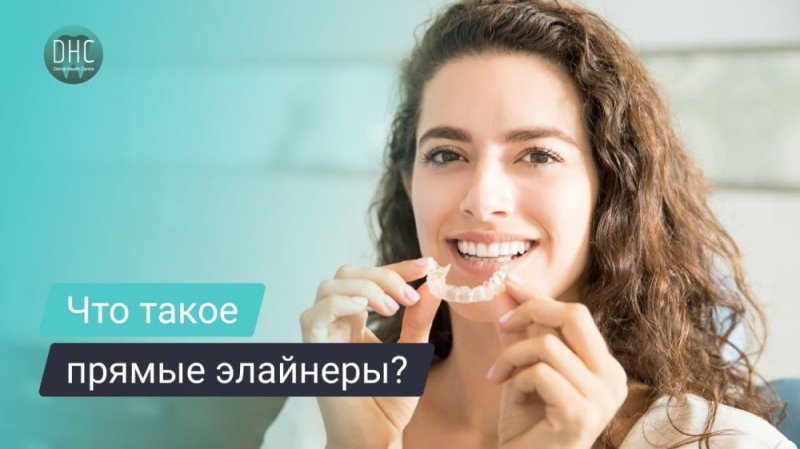 Что такое прямые элайнеры и зачем они нужны?