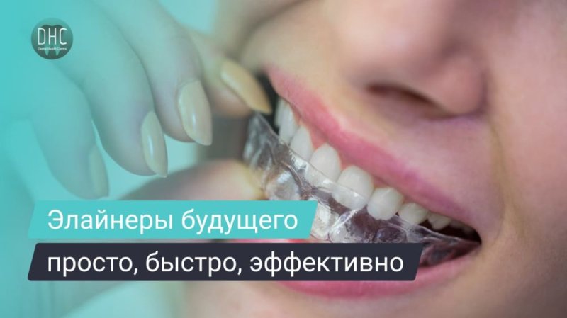 Прямые элайнеры — почему это удобно?