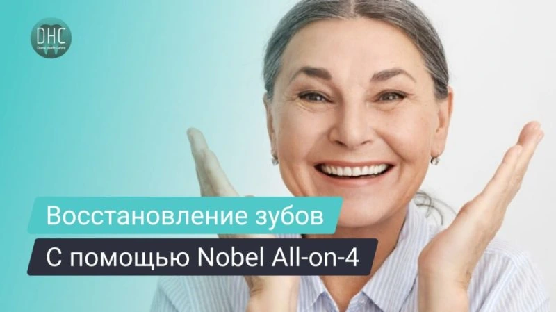 Имплантация зубов All-on-4 на имплантатах Nobel Biocare