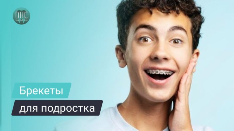 Ортодонтическое лечение брекетами для подростков