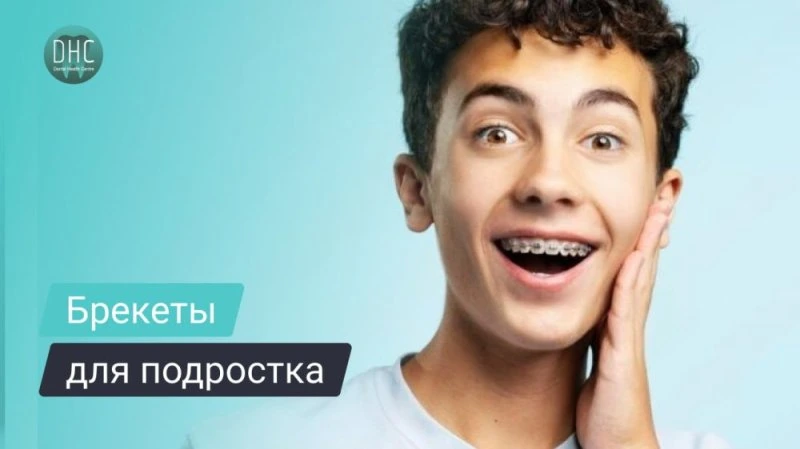 Ортодонтическое лечение брекетами для подростков