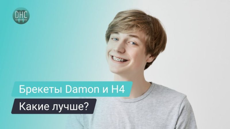 Сравнение брекетов Damon Q и H4
