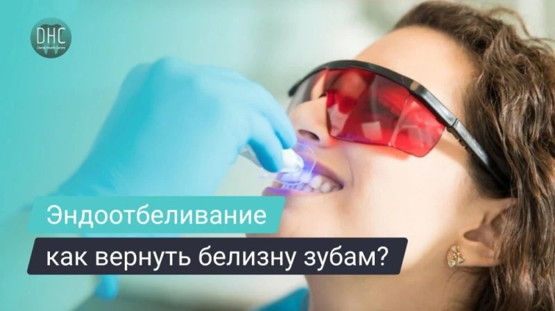 Что такое внутриканальное отбеливание зубов (эндоотбеливание)