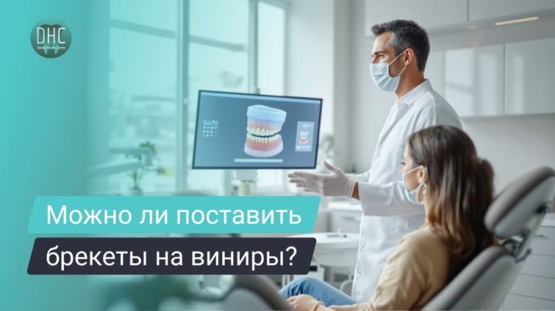 Брекеты на виниры