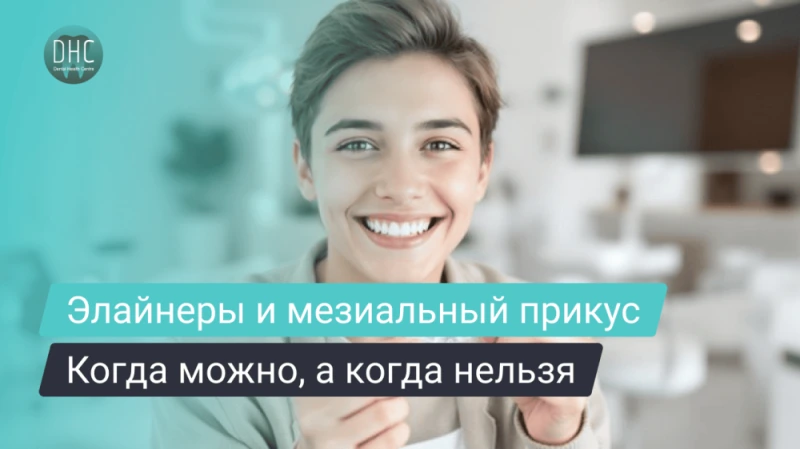 Элайнеры при мезиальном прикусе: когда это реально работает, а когда — нет