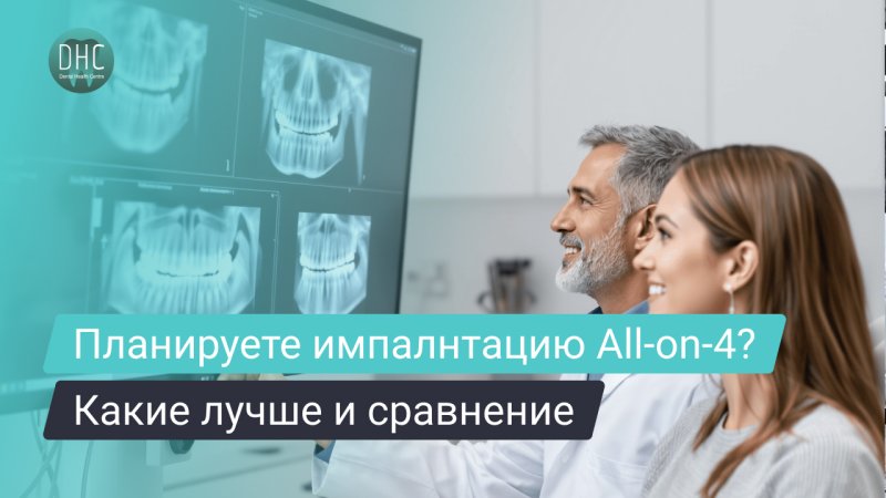 Какие импланты лучше подходят для All-on-4