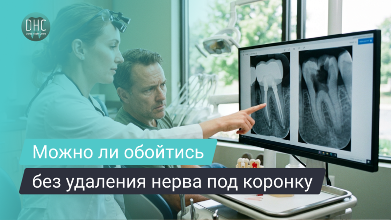 Удалять ли нерв под коронку?