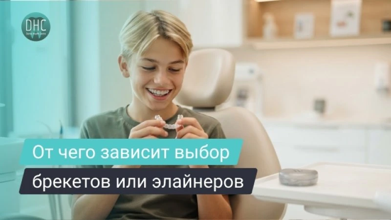 Брекеты или элайнеры для подростка: что выбрать и от чего зависит решение
