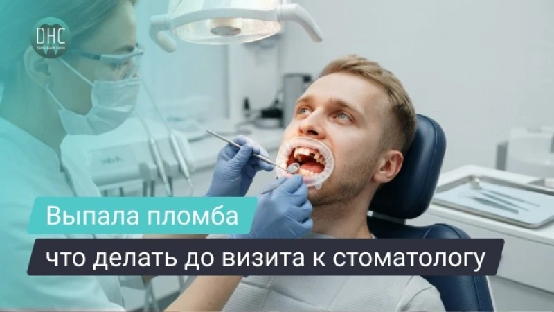 Выпала или откололась пломба: что делать и как восстановить зуб