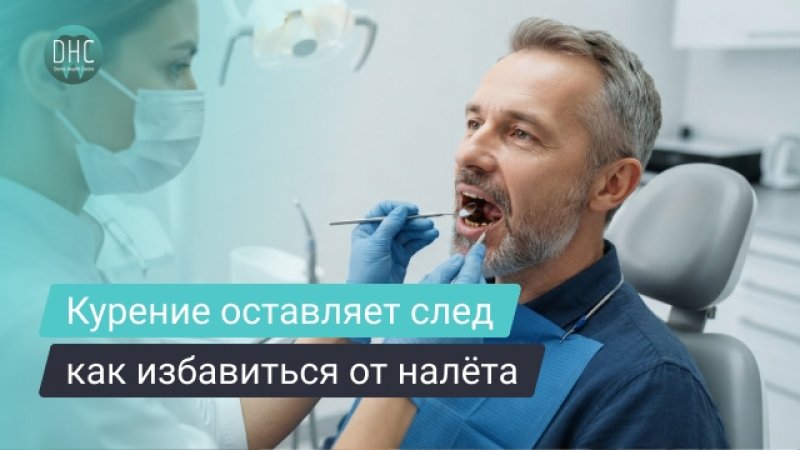 Налёт от курения на зубах: почему появляется и как его убрать