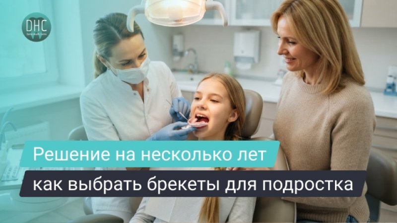 Брекеты для подростков: как выбрать систему, пройти лечение и получить результат