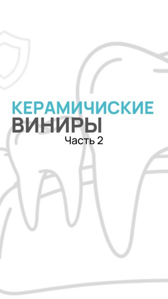 Что такое керамические виниры