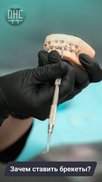 Зачем ставить брекеты?