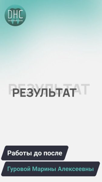 Работы до после: Гуровой Марины Алексеевны