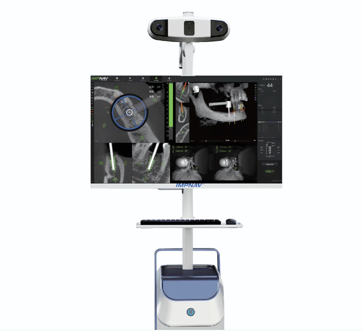 Система динамической навигации IMPNAV